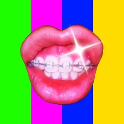 Wisdom Tooth Removed